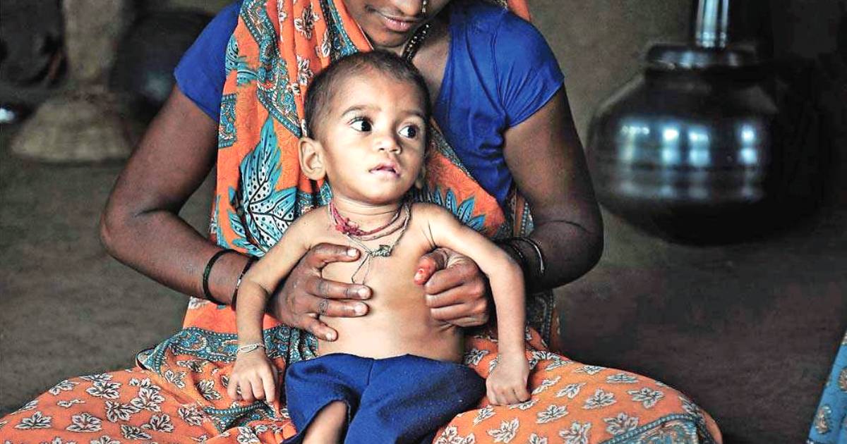 WILL GUJARAT EVER MANAGE TO END MALNOURISHMENT IN KIDS?